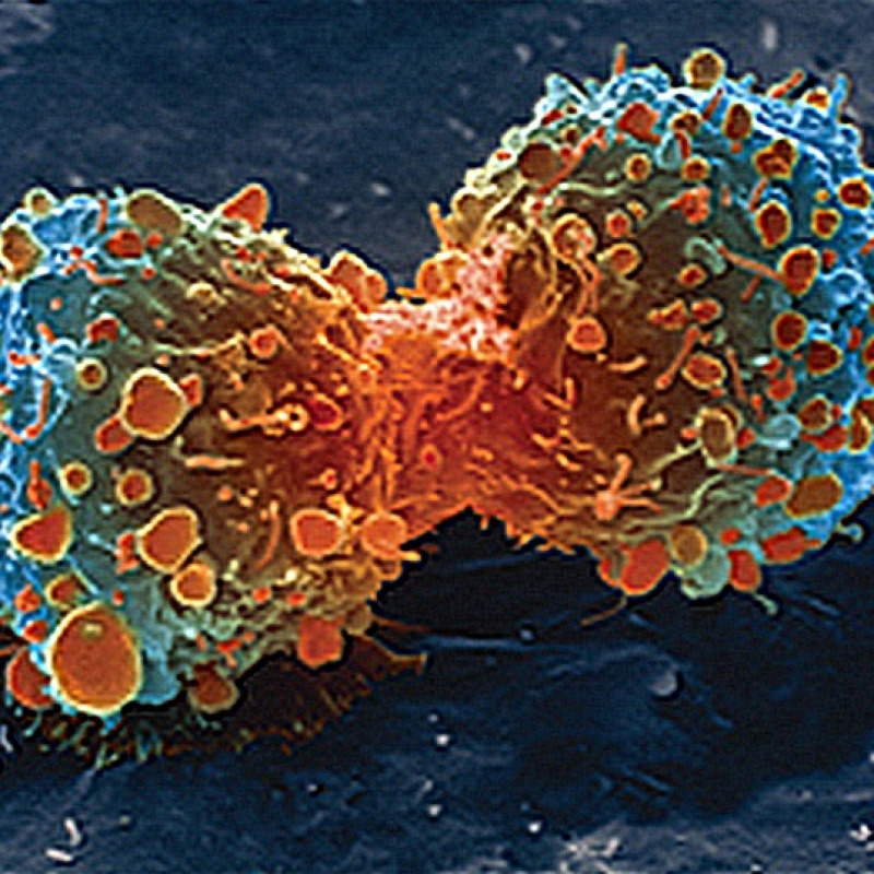 Il momento della divisione cellulare durante la creazione del cancro (fonte: United States: National Institutes of Health)