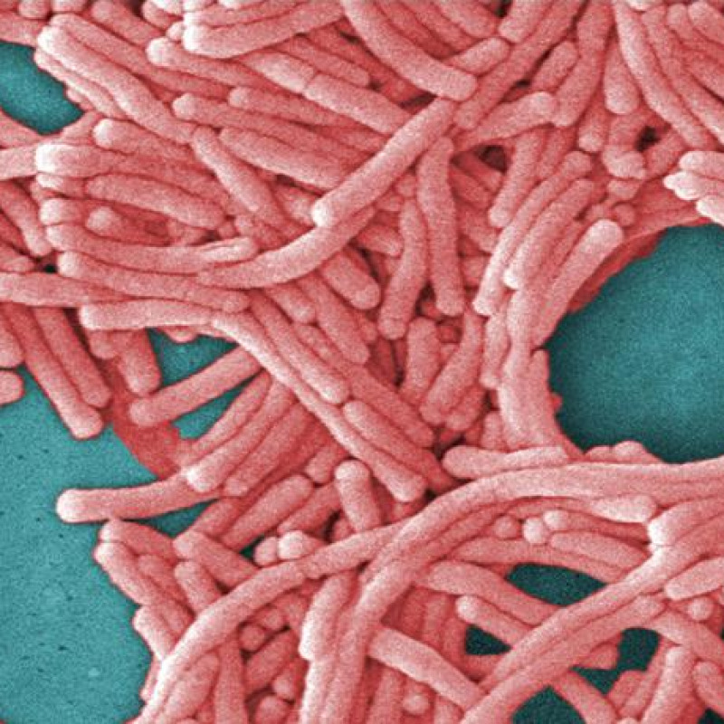 Il batterio che provoca la Legionella